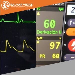 Electrocardiografía y Monitorización para TES