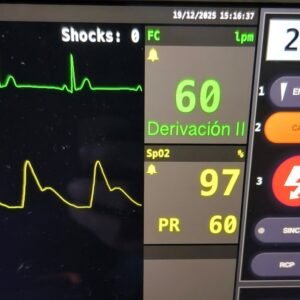 Electrocardiografía y Monitorización para TES